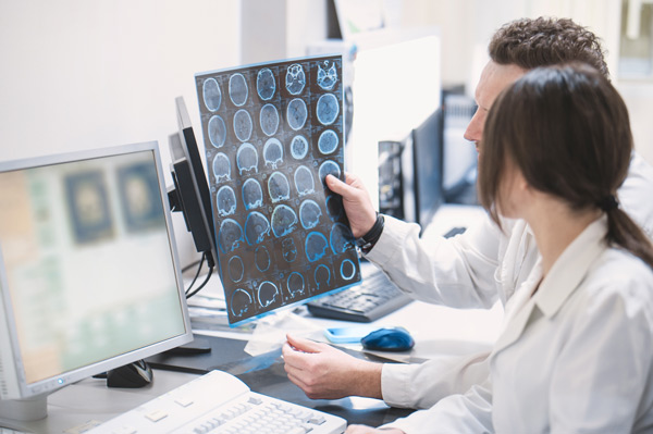 Médicos observando radiografías del cerebro
