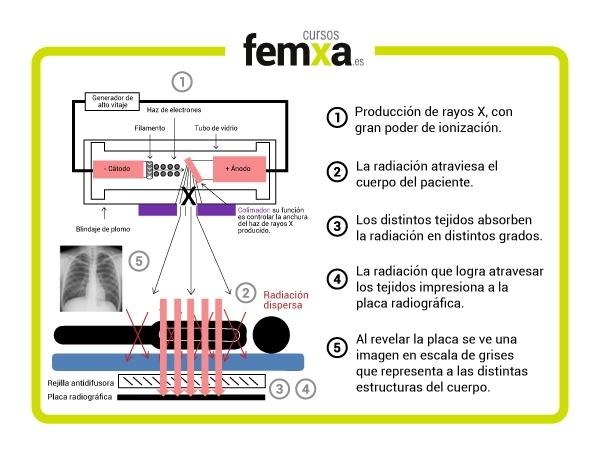 funcionamiento de un aparato de rayos X